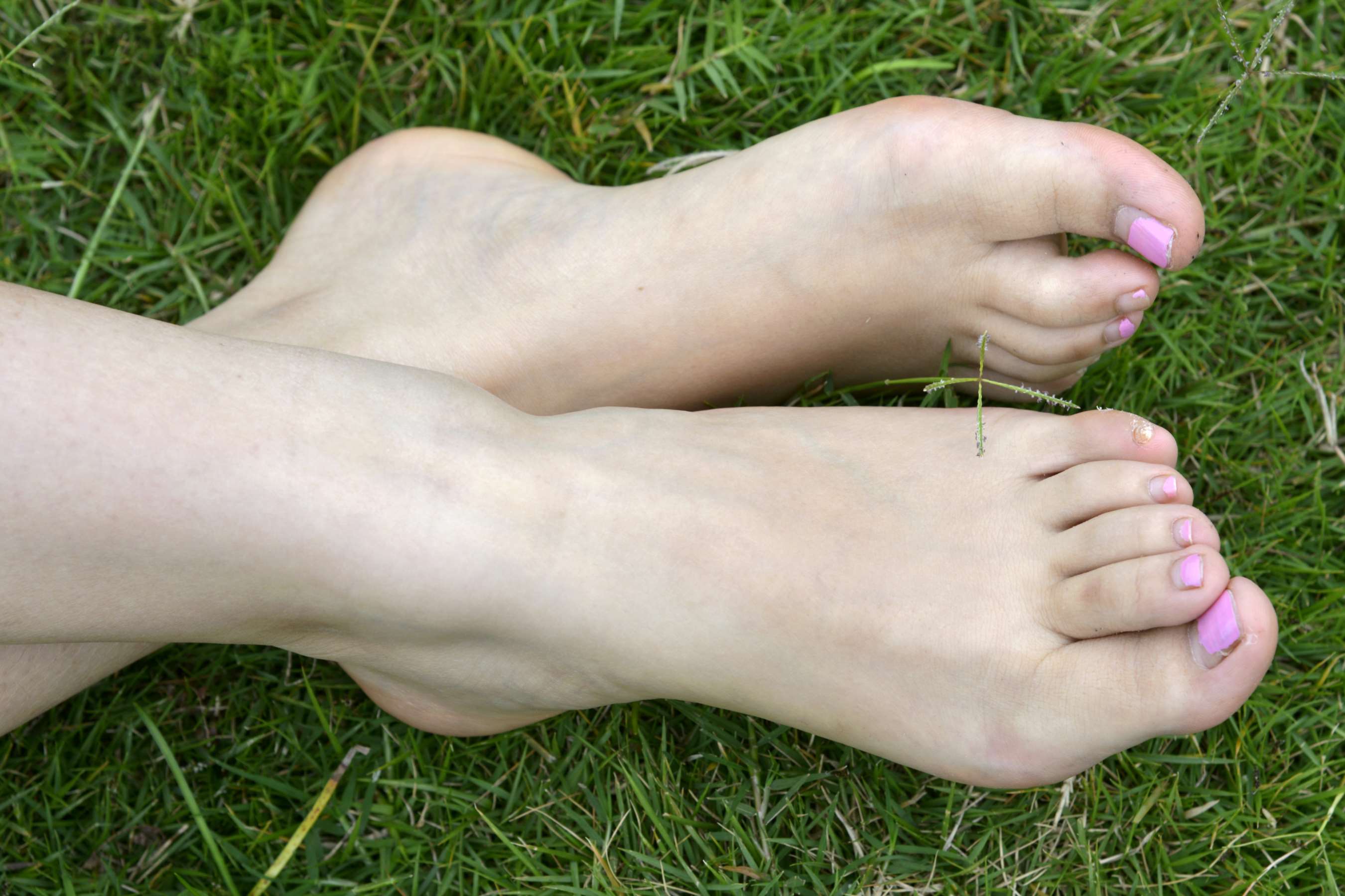 《小鹿裸足》作品图