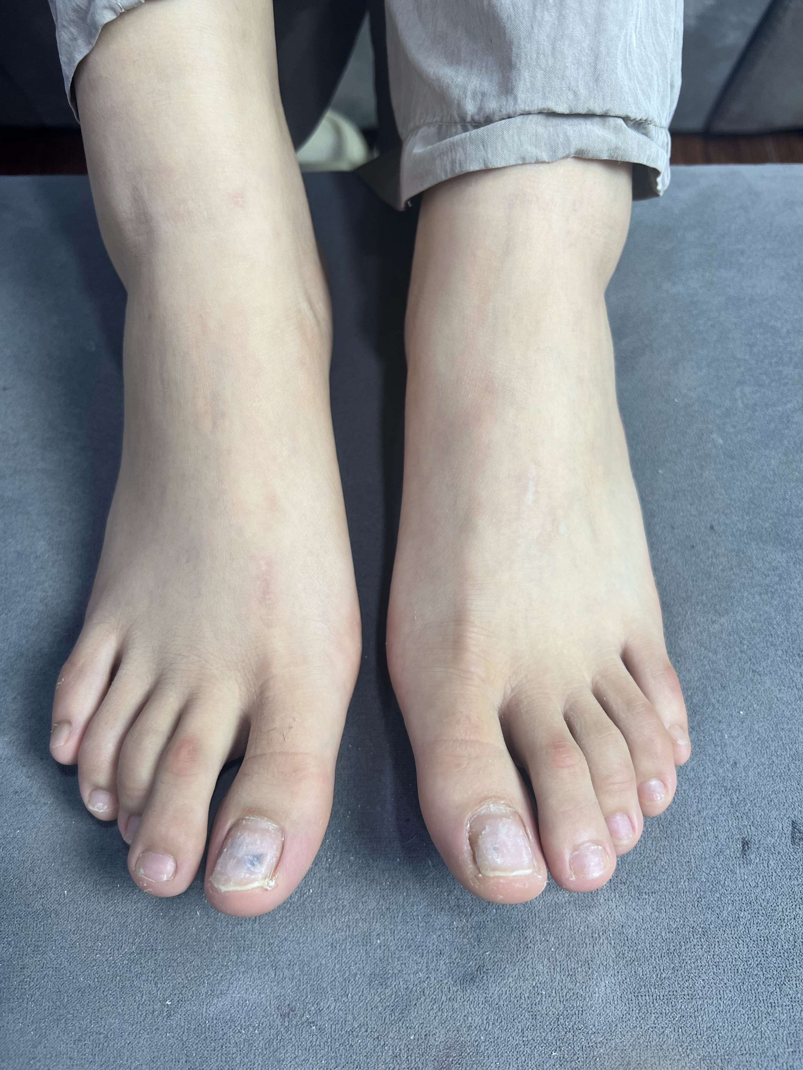 《眼镜妹的大嫩足》作品图