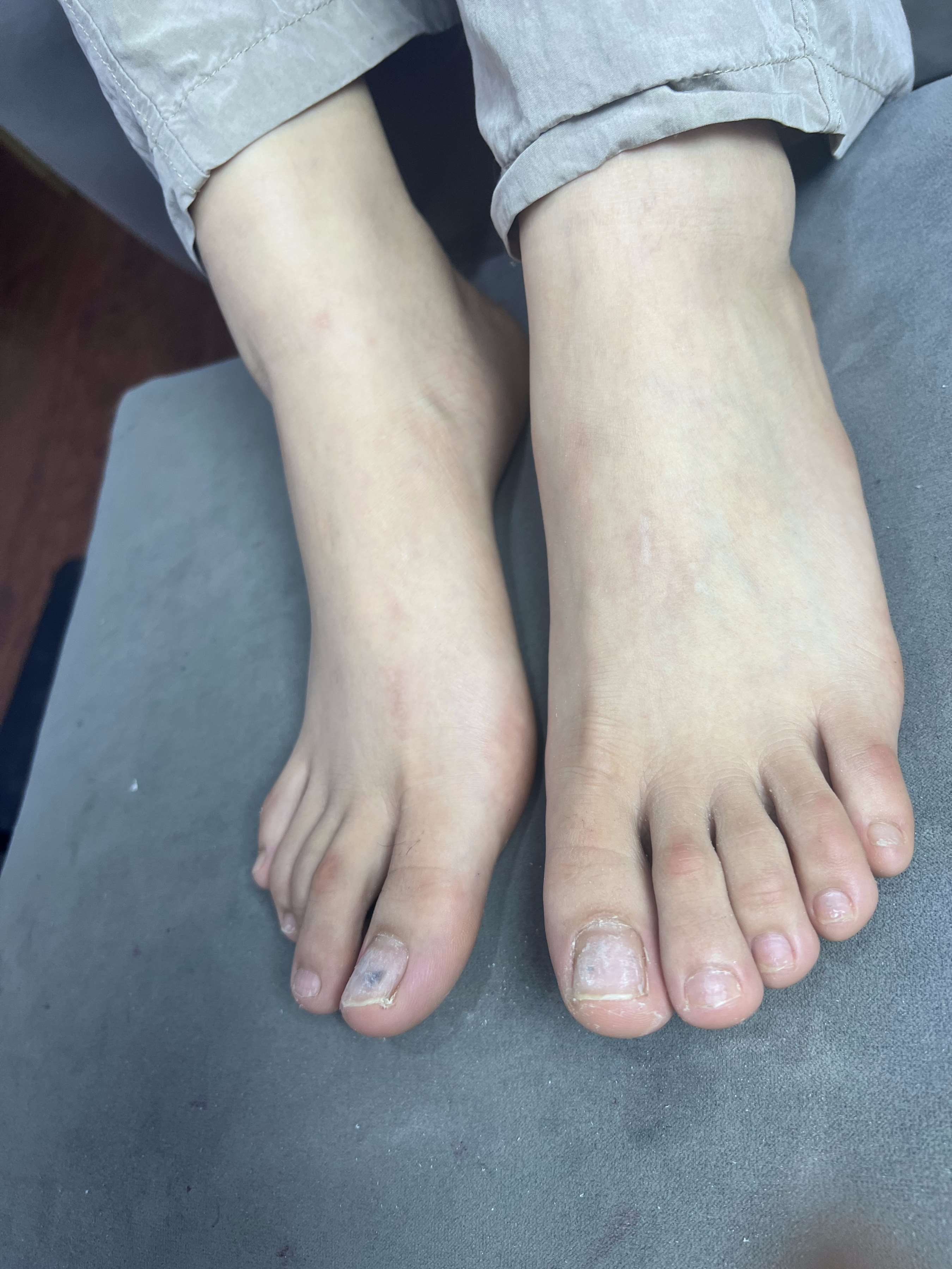 《眼镜妹的大嫩足》作品图