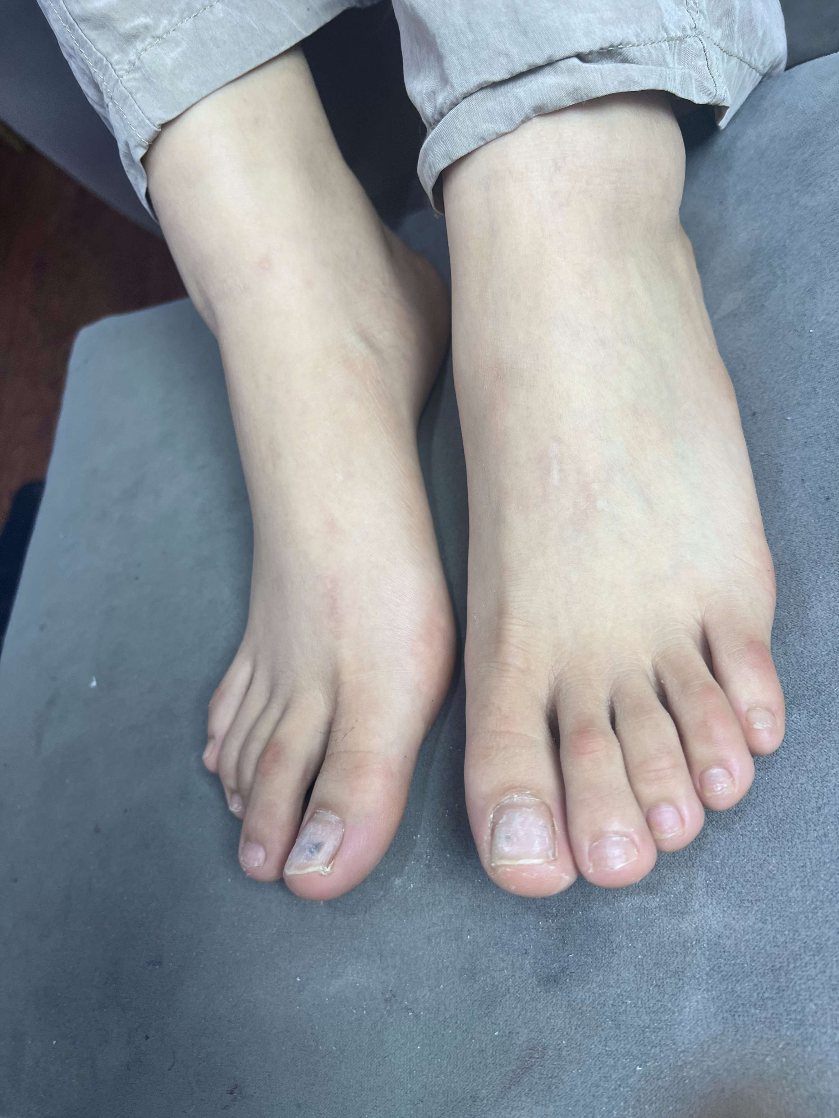 《眼镜妹的大嫩足》作品图