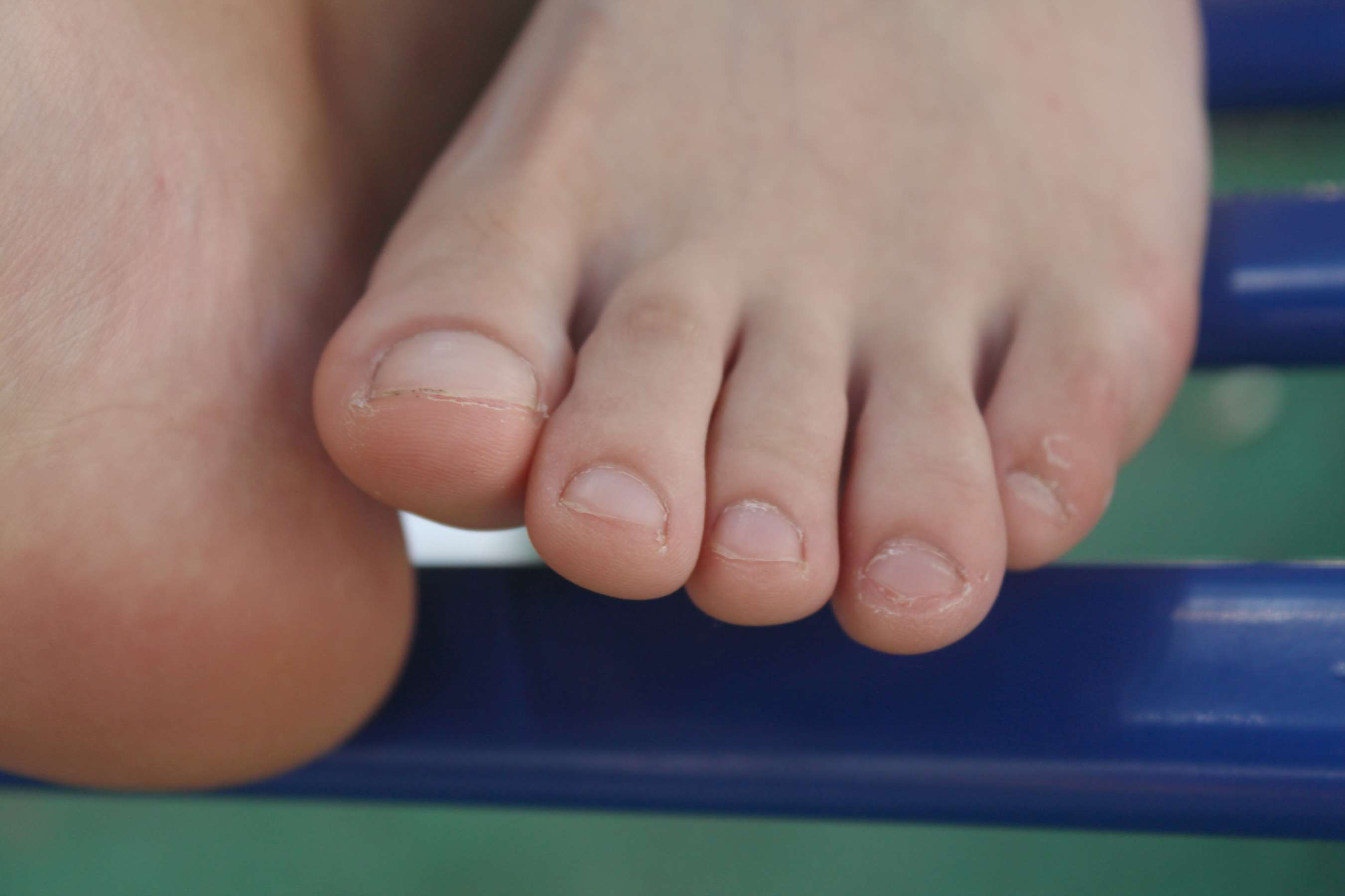 《略为丰满少女的可爱美足》作品图