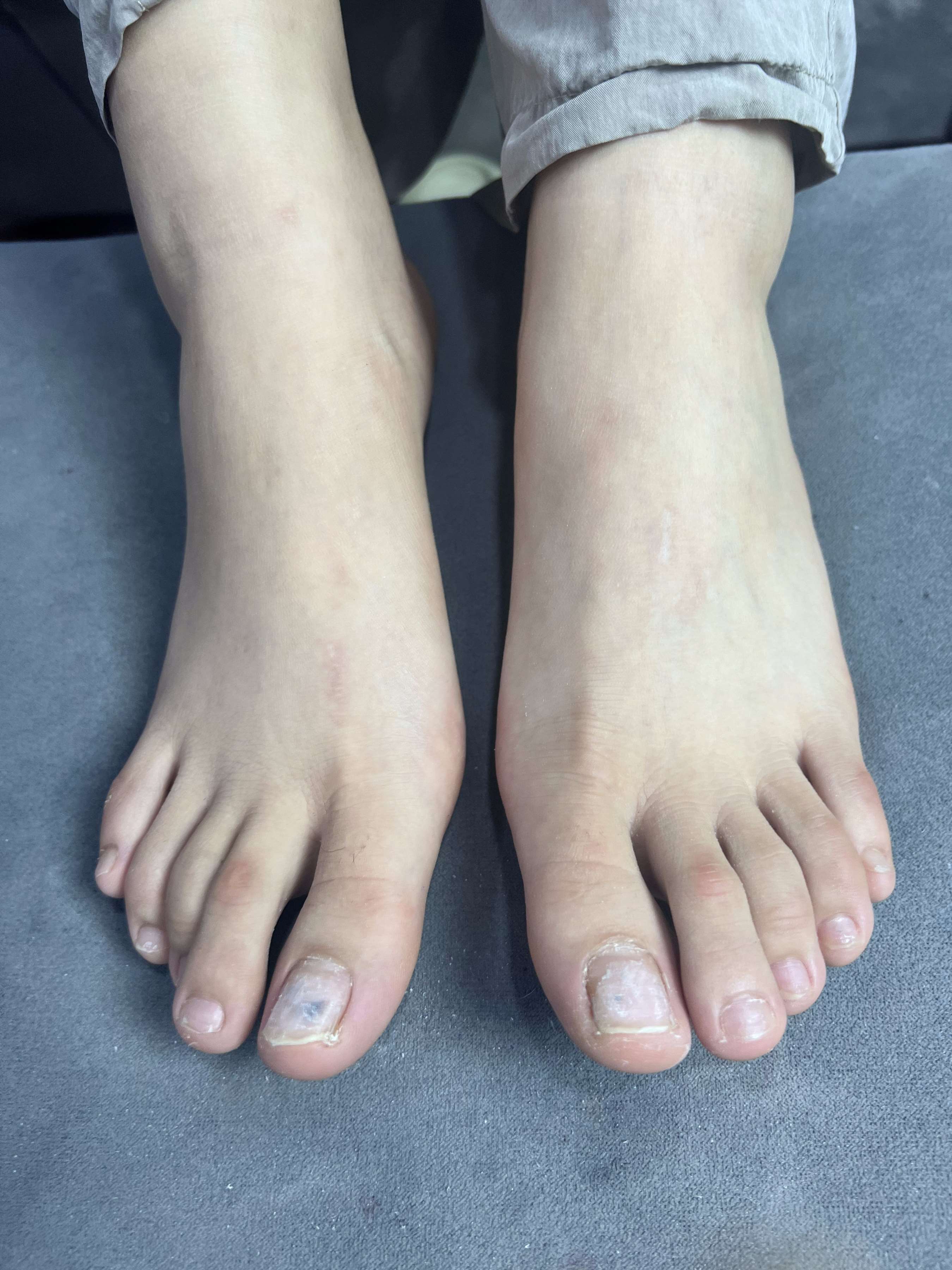 《眼镜妹的大嫩足》作品图