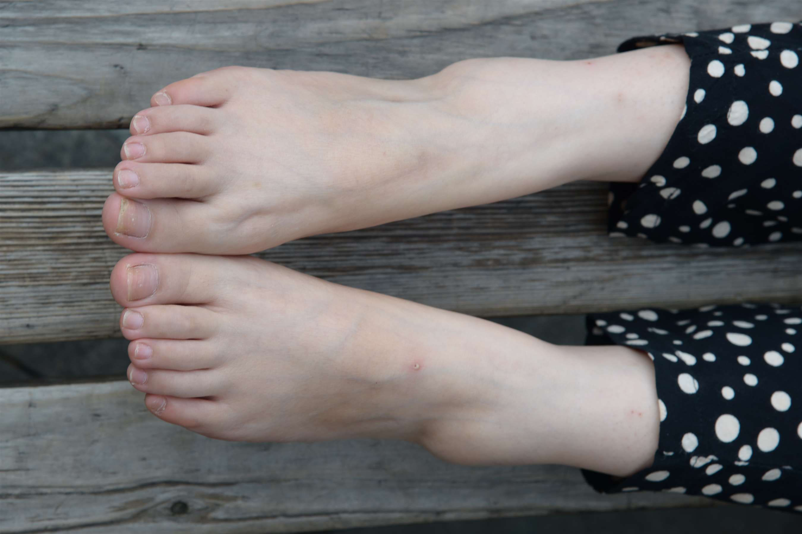 《不露脸的斑点裙の裸足脚丫 》作品图