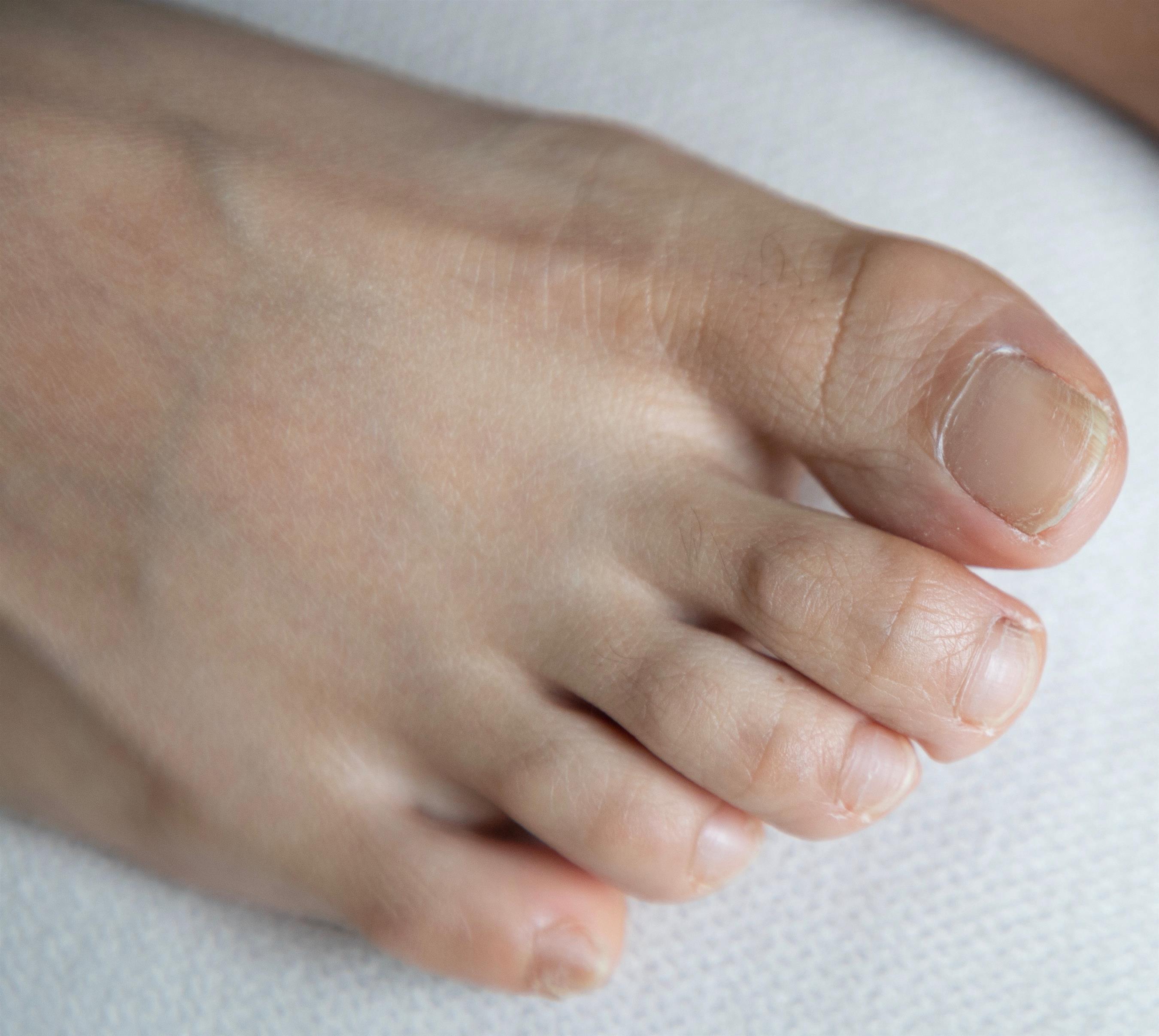 《脏脏的板鞋の棉袜脚+视频1个》作品图