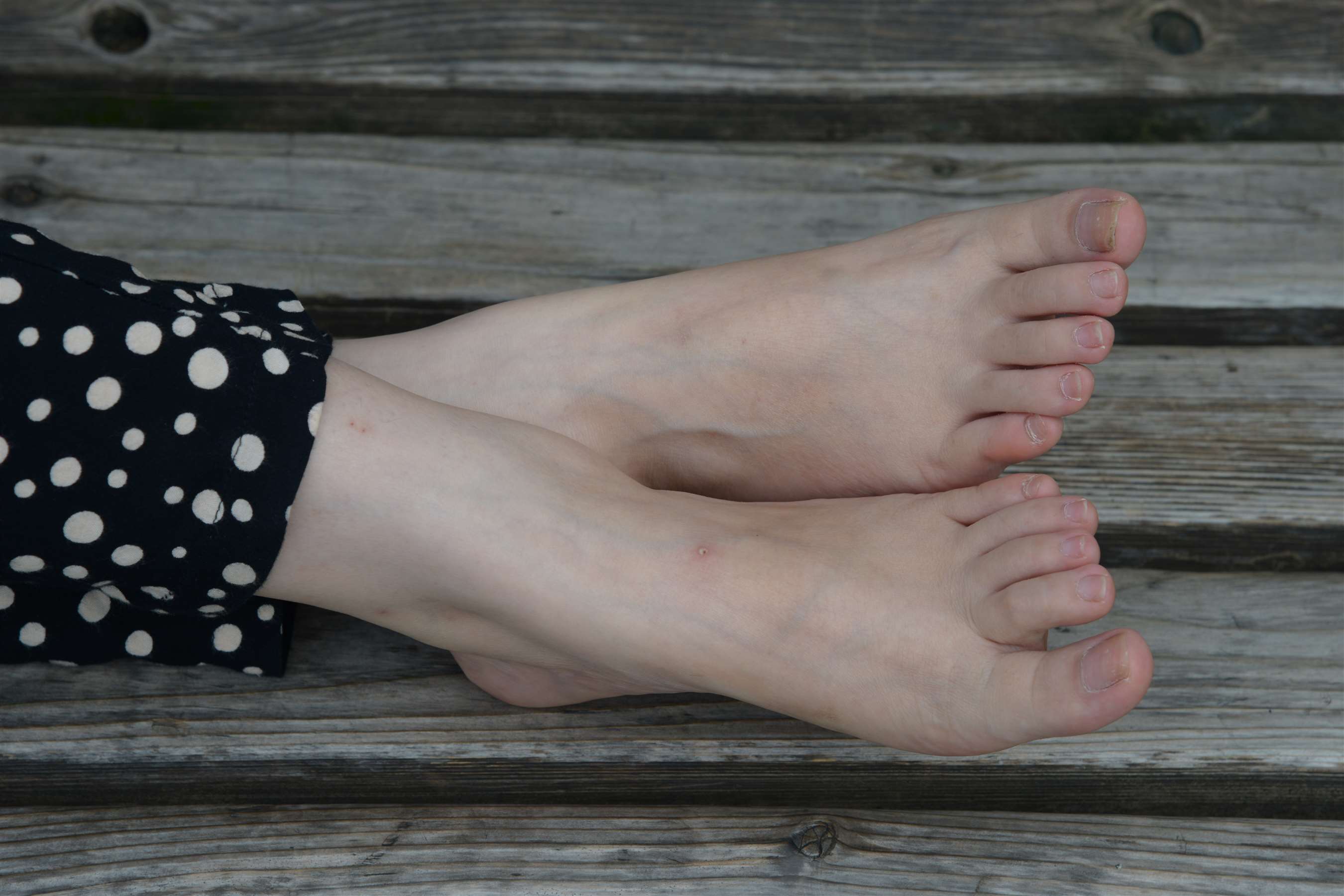 《不露脸的斑点裙の裸足脚丫 》作品图