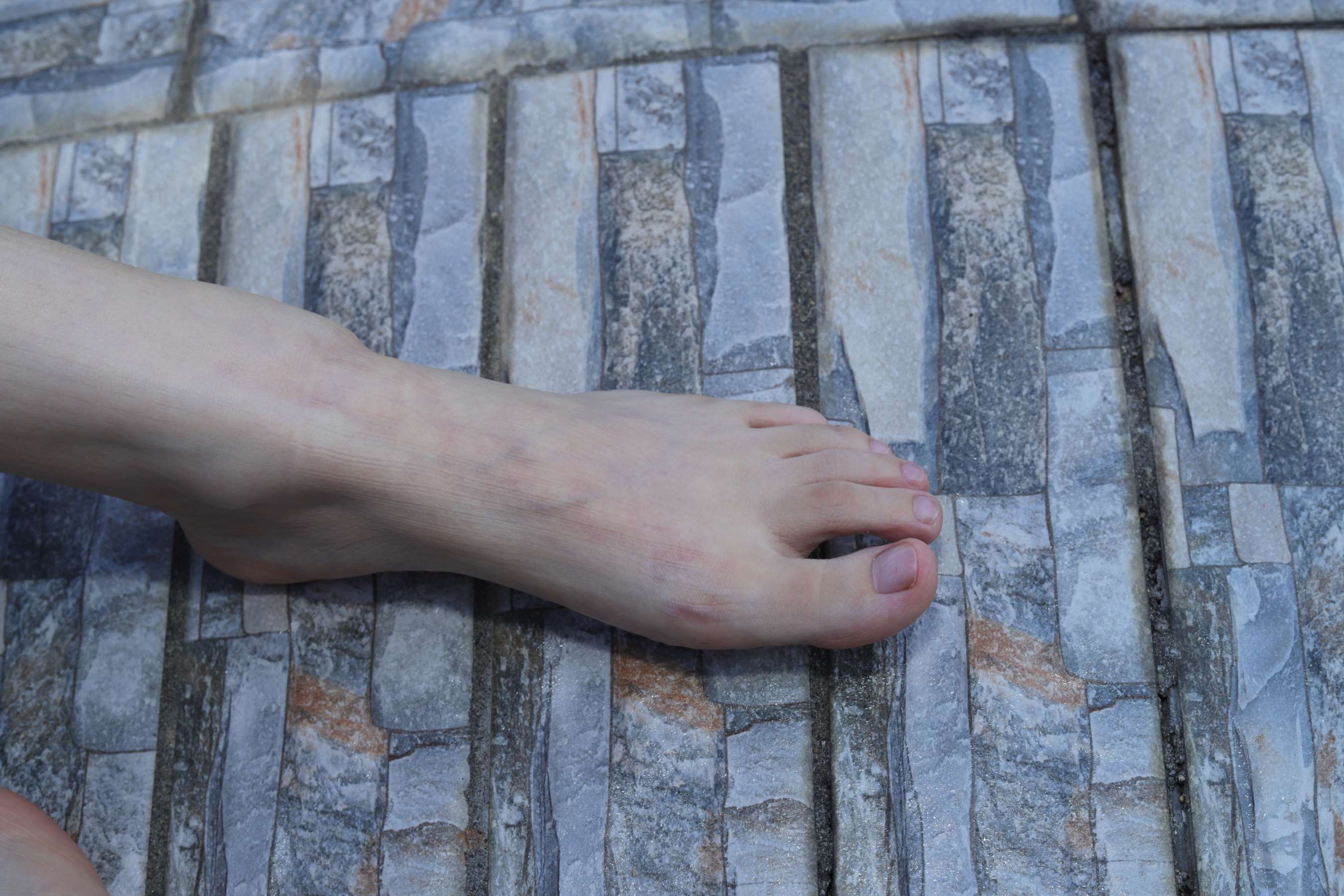 《美女小芳公园脱掉鞋袜展示极品脚丫》作品图