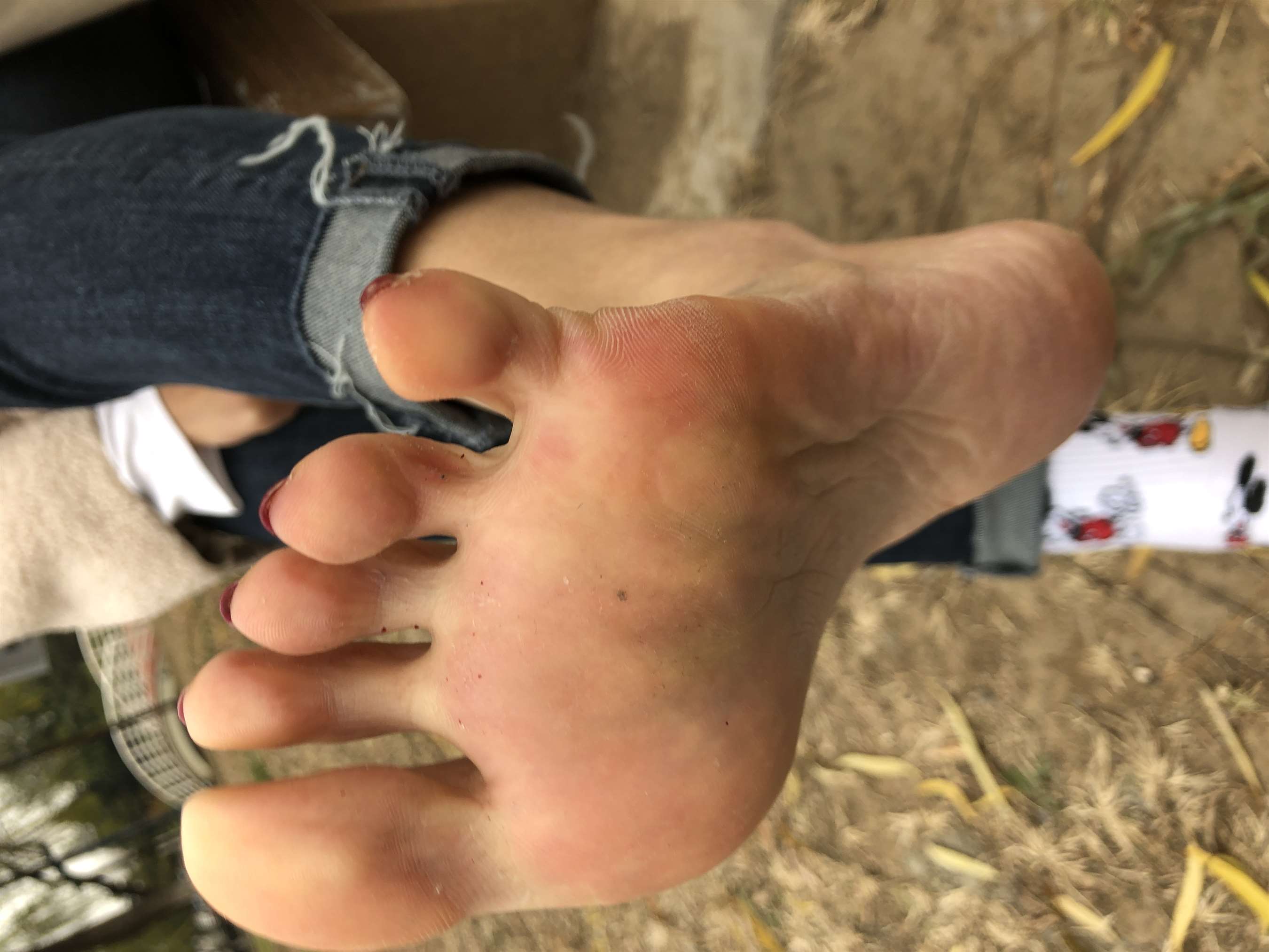 《脱棉袜展嫩足》作品图