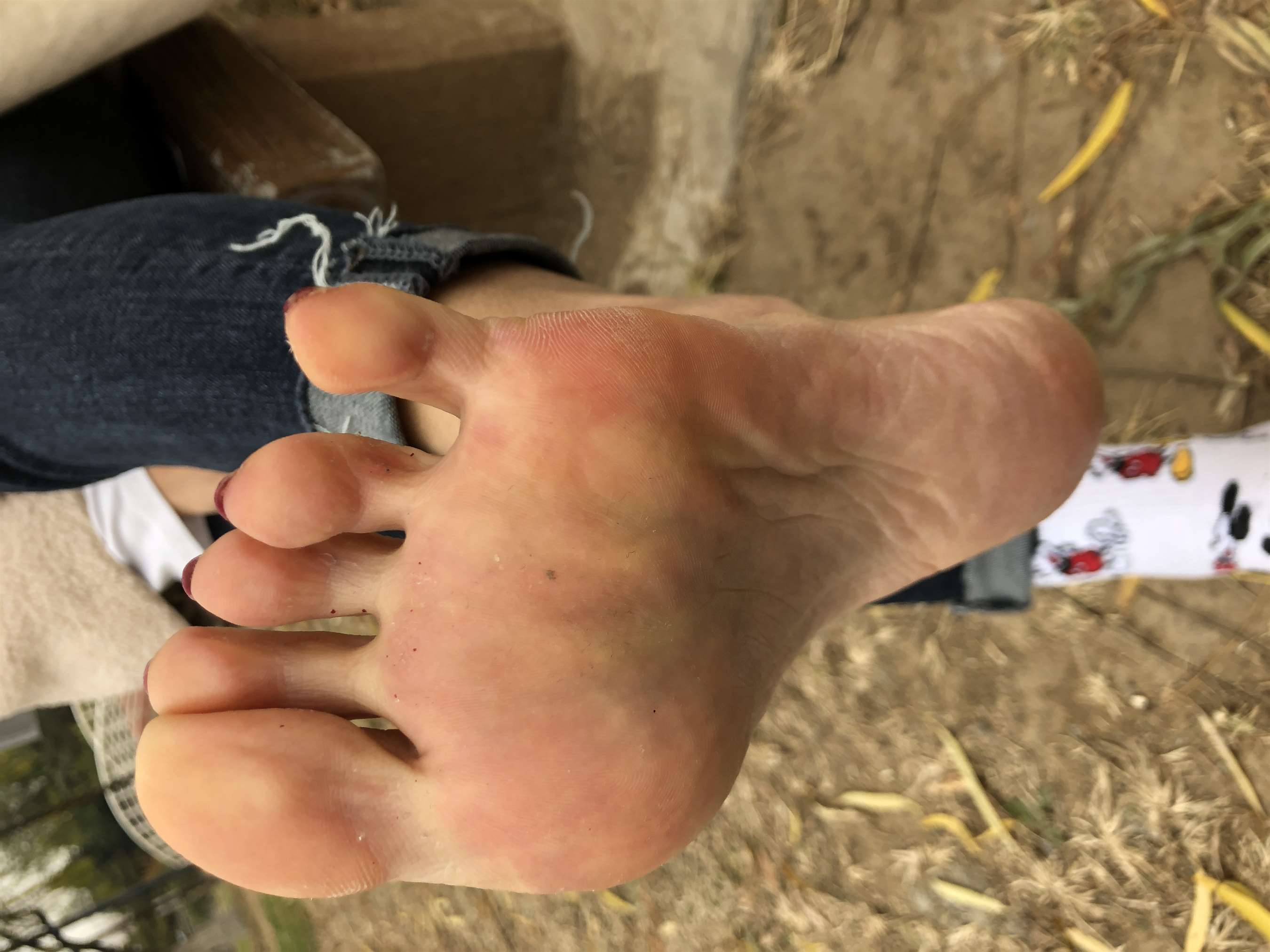 《脱棉袜展嫩足》作品图