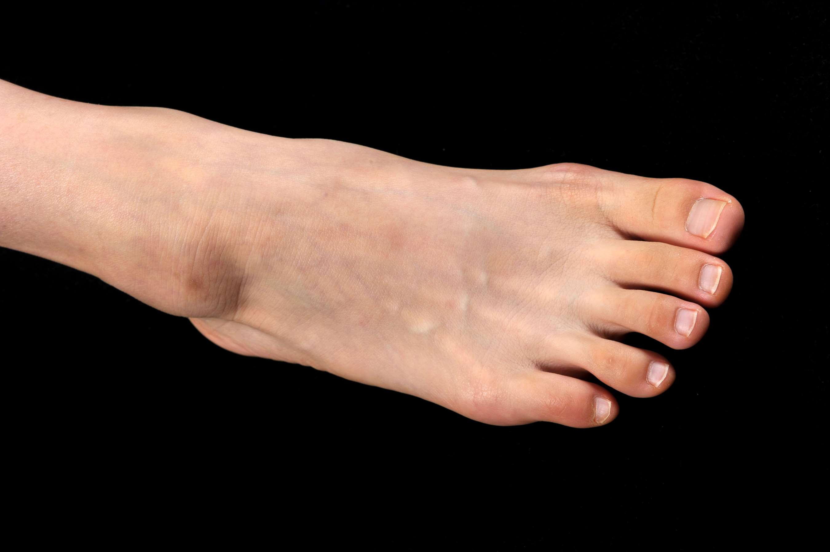 《翼子 黑裙の嫩足》作品图