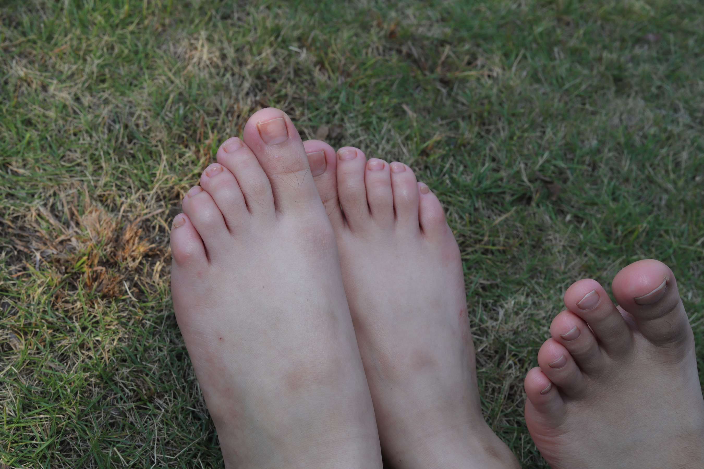 《诗诗与小然户外展示原味嫩脚丫》作品图