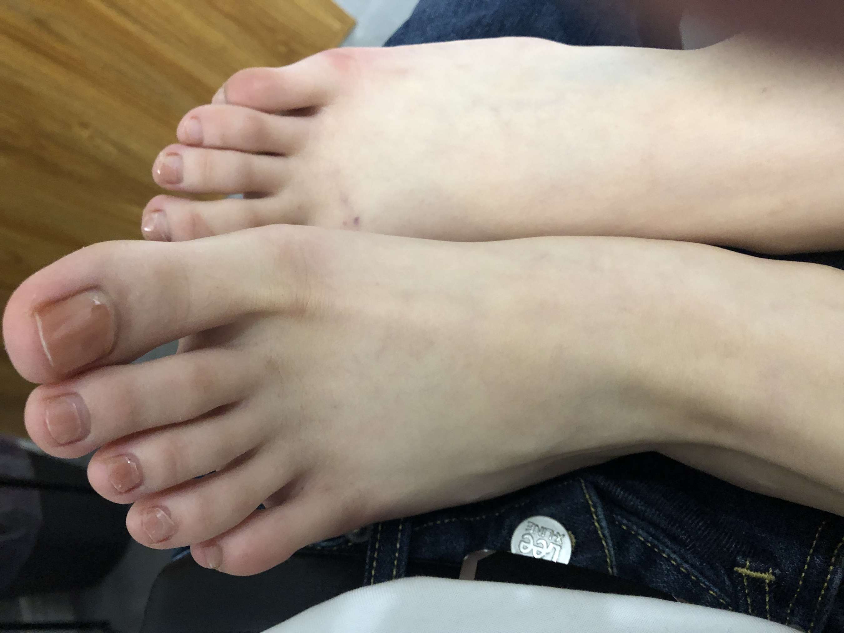 《少女的大脚丫》作品图