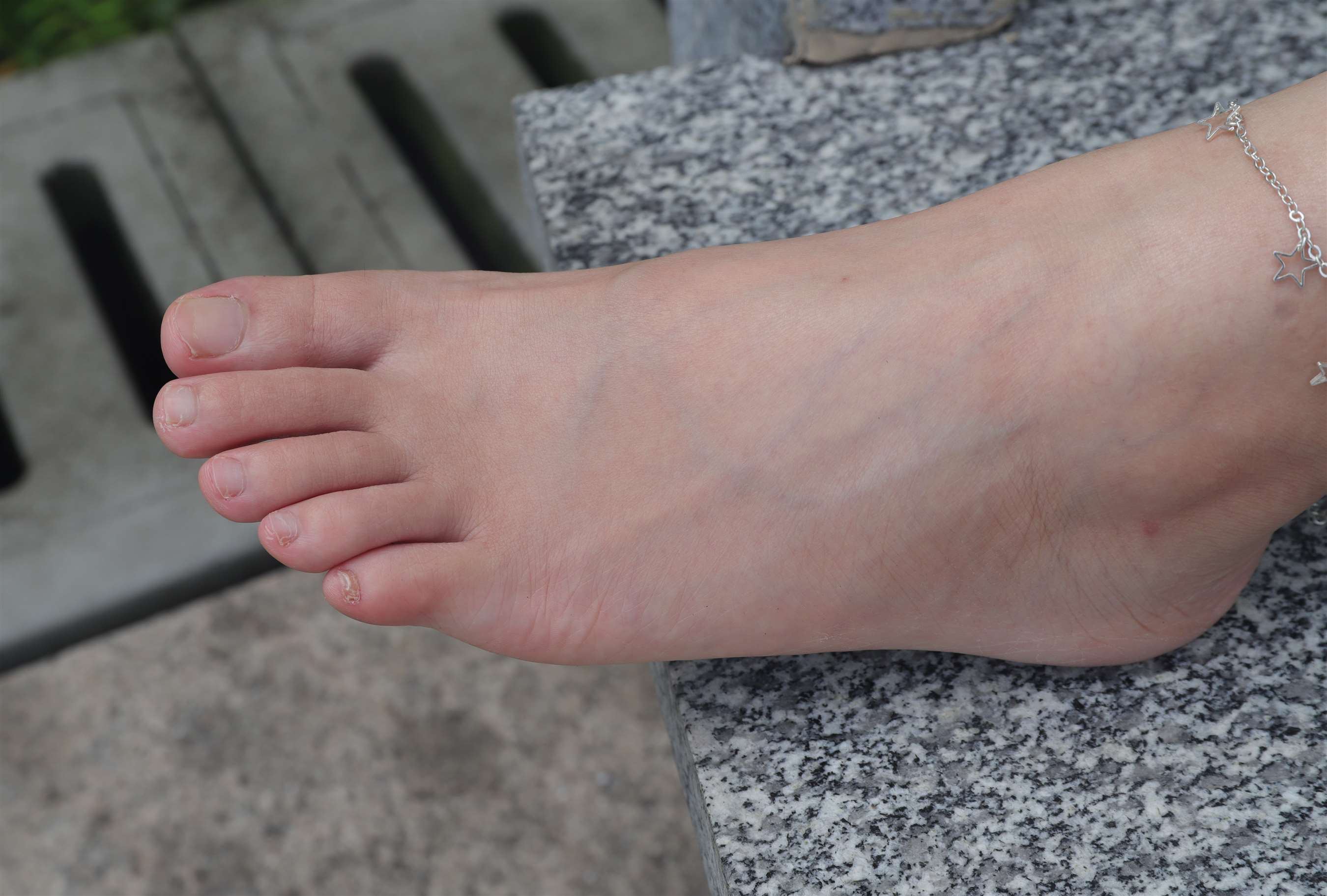 《慧婷公园展示脚丫》作品图