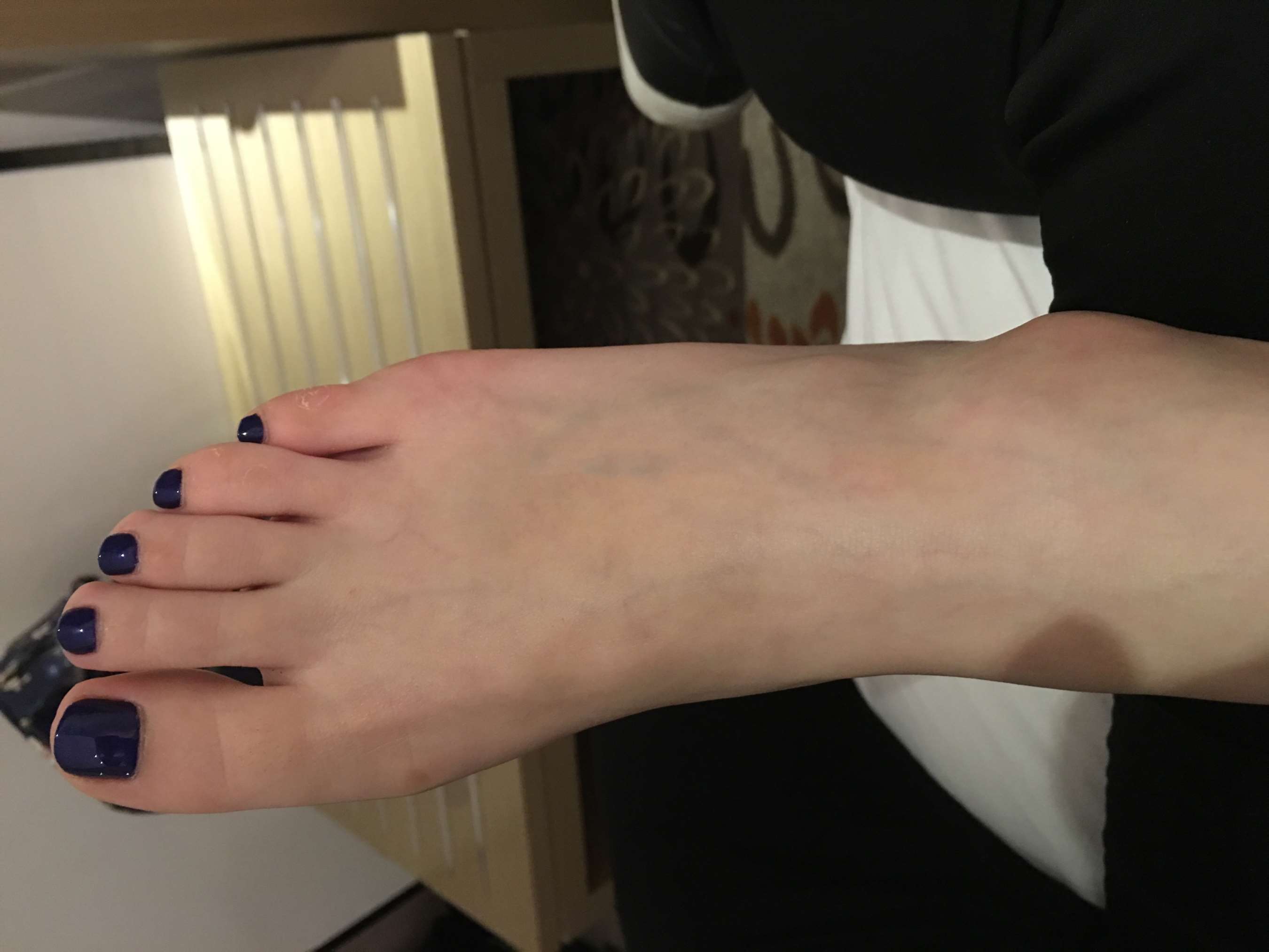 《涂指甲油的光脚丫》作品图