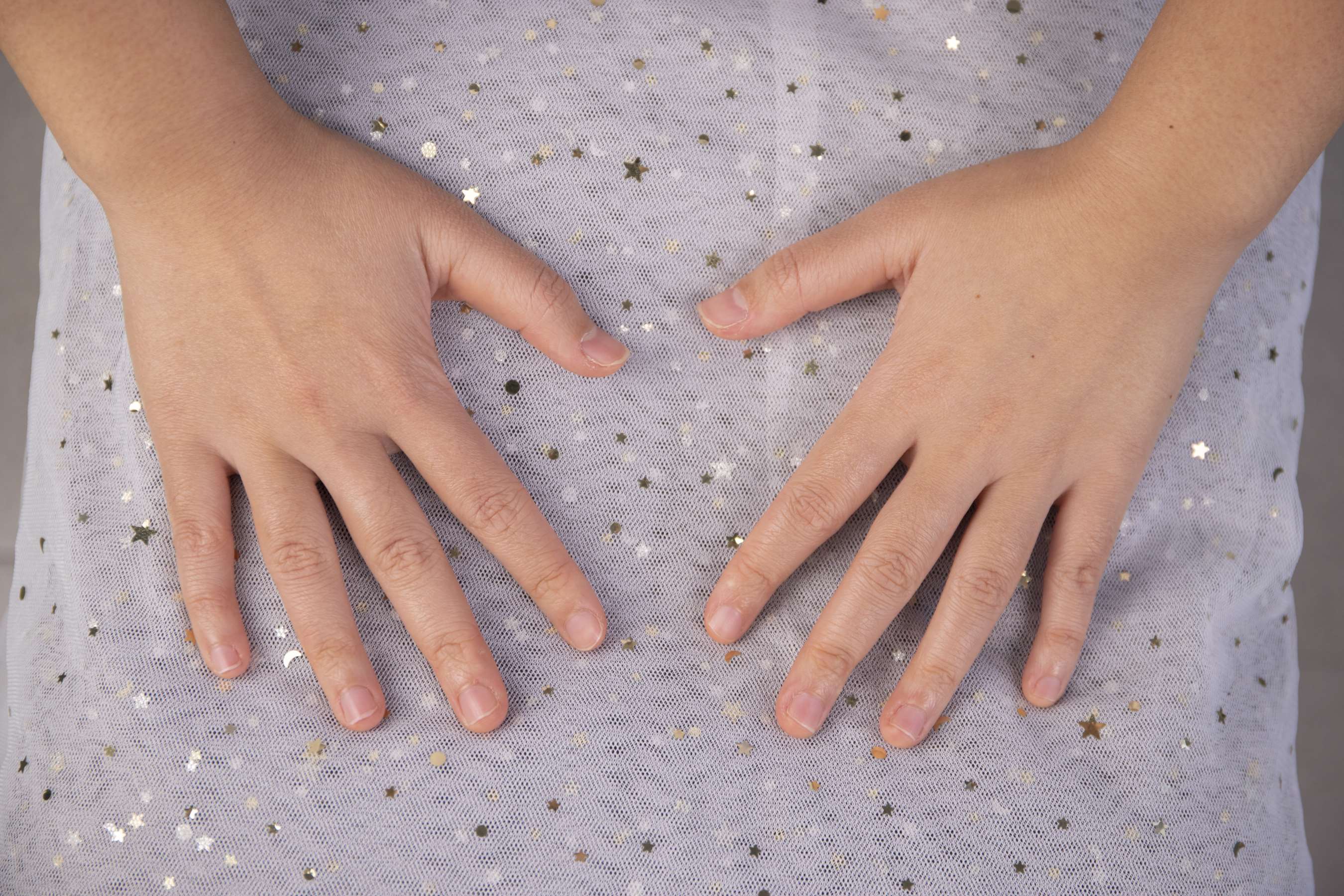 《脚气女孩小玲的原味棉袜脚丫，有点重口味！》作品图